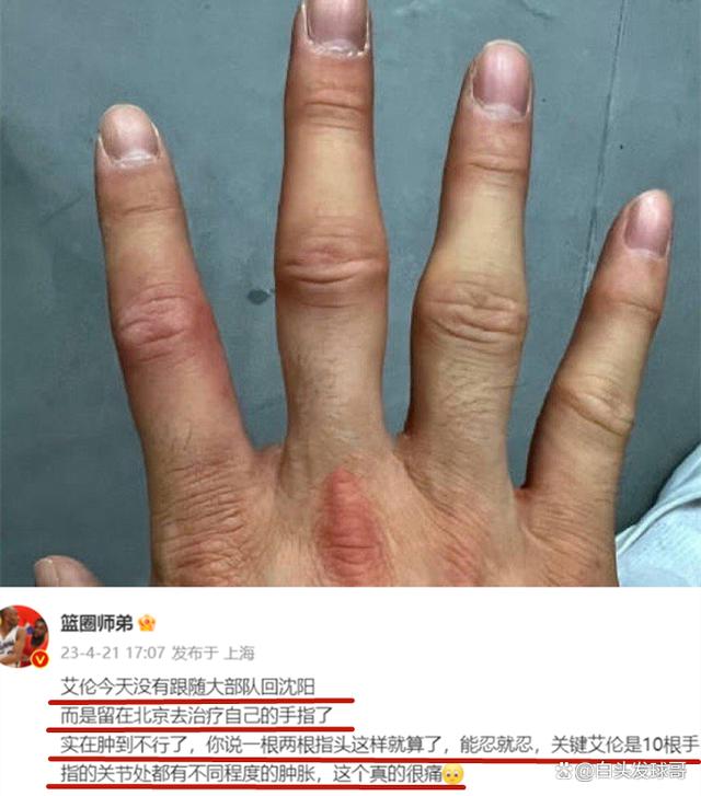 包含澳大利亚联赛新赛季主力球员出现意外伤情的词条 包含澳大利亚联赛新赛季主力球员出现意外伤情的词条